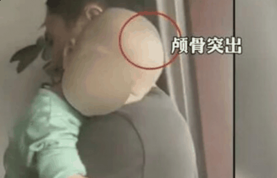 湖南郴州再潮牌资讯现大头娃娃（湖南郴州再现大头娃娃是怎么回事 大头娃娃奶粉是哪个牌子）