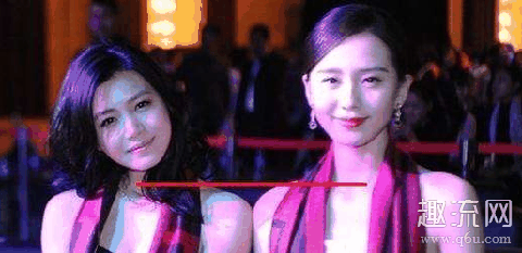 脖子短的人适合什么领的衣服 脖子短是什么原因 怎么变长