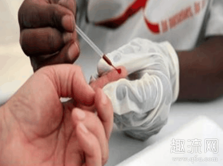 无症状感染者是确诊病例吗 无症状感染者和潜伏期的区别