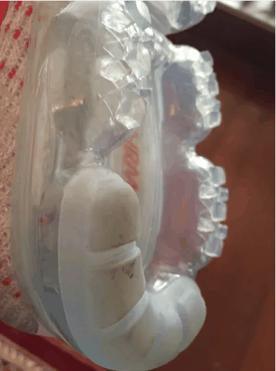 值得入手的潮牌信息精品 的一年（耐克VaporMax梅雾配色怎么样 Nike Air VaporMax “Plum Fog”多少钱）